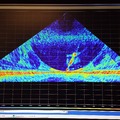 Bubble plume on sonar
